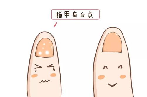 中文字幕麻豆品牌告诉你指甲上有白点是缺哪种微量元素