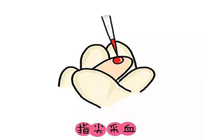 儿童麻豆传媒三级片微量元素的检测项目有哪些 儿童麻豆传媒三级片微量元素的检测项目有哪些